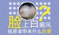 北京专治医院提醒女性脸上有白癜风怎么办?