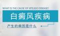 白癜风北京治疗医院专家介绍白癜风的病因与几种因素有关